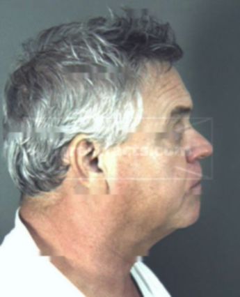 Lawrence Ovid Mclendon