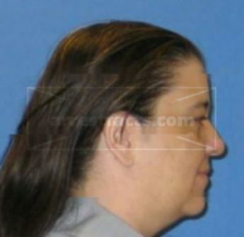 Jennifer L Robbins