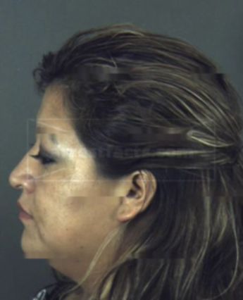 Aurelia Guadalupe Lopez