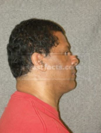 Edwin Deleon