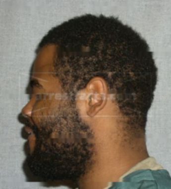 Zeron D Harrell
