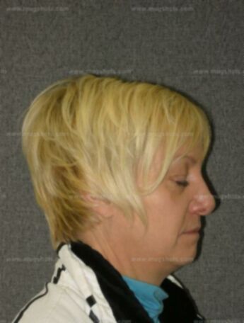 Lynn M Mitchell