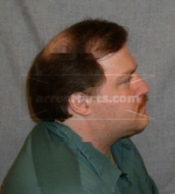 Harold Hausz