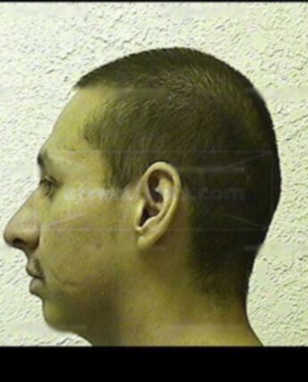 Anthony J Lafountain