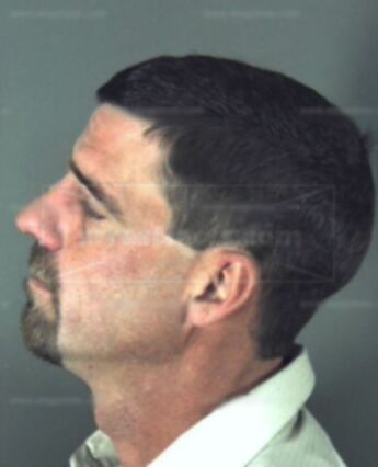 Anthony Brian Milbourne