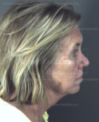 Barbara Krohn Noyes