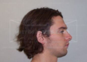 Zachary J Dekker