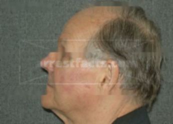 Robert G Hagerstrand