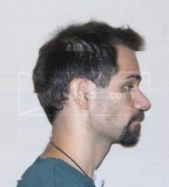 Daniel Landis