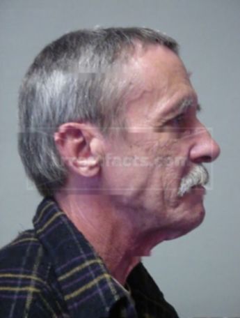 Jeffrey A Norton