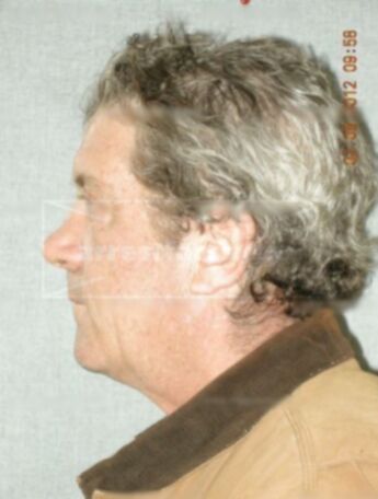 Gregory W Schaefer