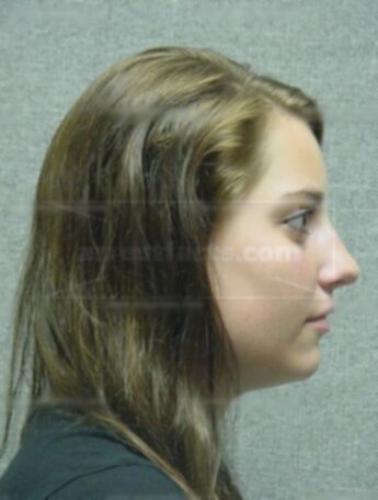Angela D Burkholder