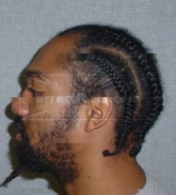Levon D Chapman