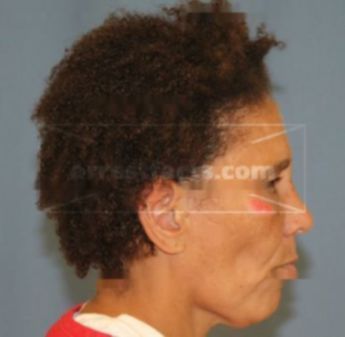 Brenda L Adams