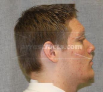 Jeffrey J Benke