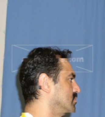 Robert R Morales