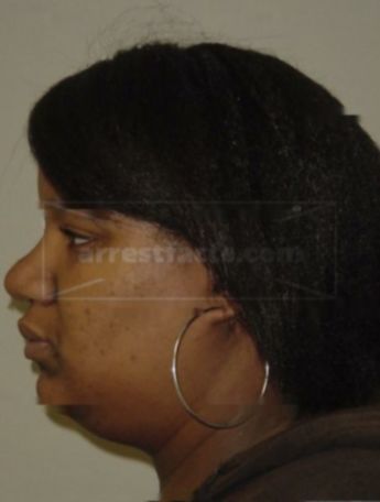 Ashanti S Watson