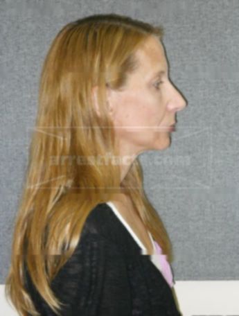 Laura L Meyer
