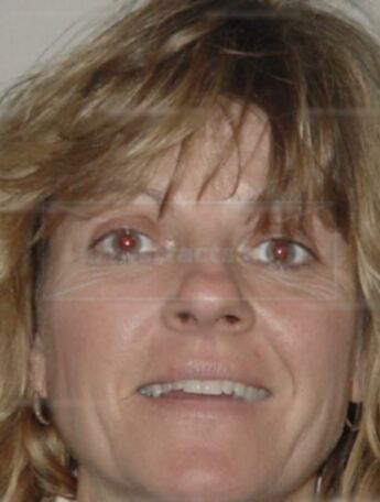 Jacqueline J Kuss