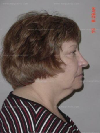 Sandra J Langer