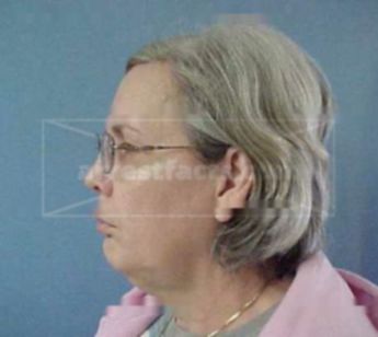 Carol S Sommers
