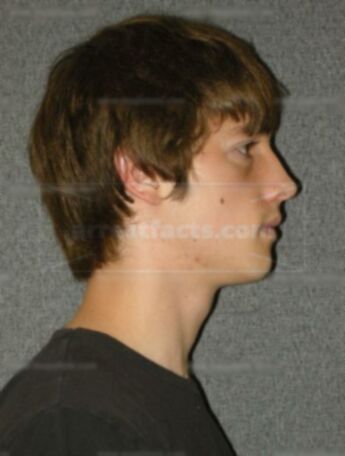 Andrew J Metko