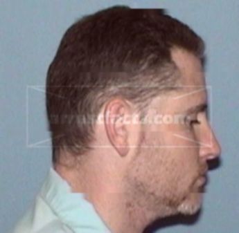 Randy Lee Anderson