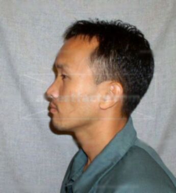 Keo Vang