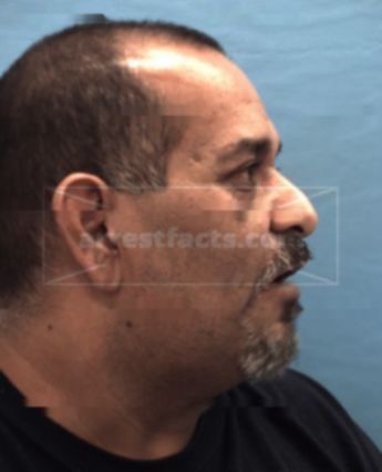 Arnulfo Fuentes Rendon