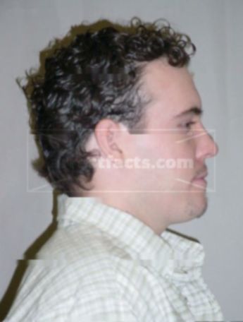 Lucas M Campion