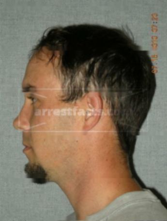 Jesse J Dumpprope