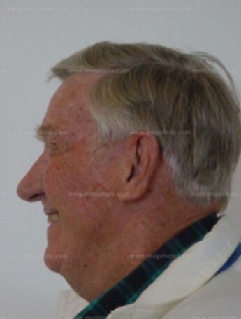Lawrence E Pflueger