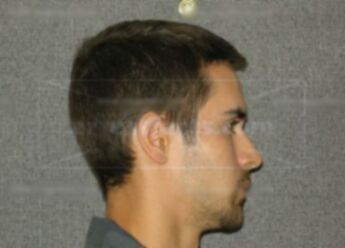 Patrick J Blakeslee