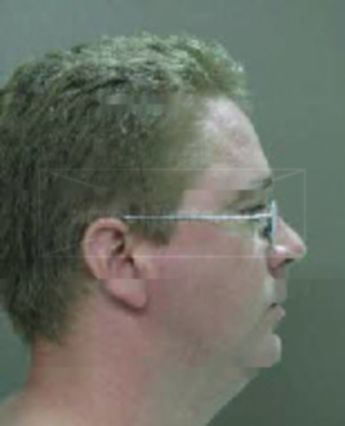 Raymond P Maddux