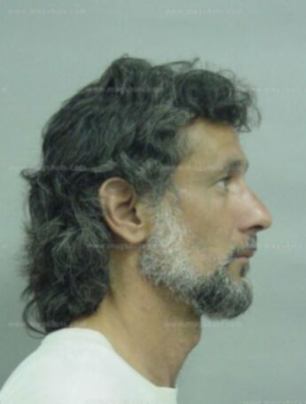 Richard C Karides