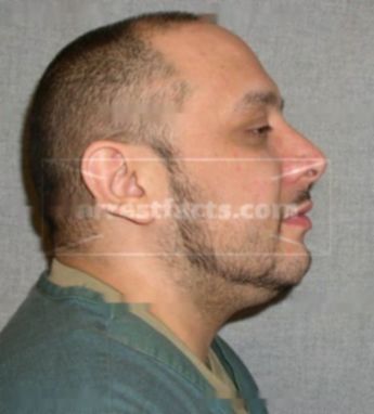 Juan A Tirado