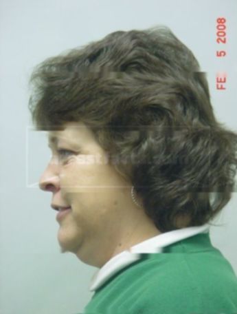 Elizabeth S Heinz