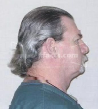 Robert A Hartline