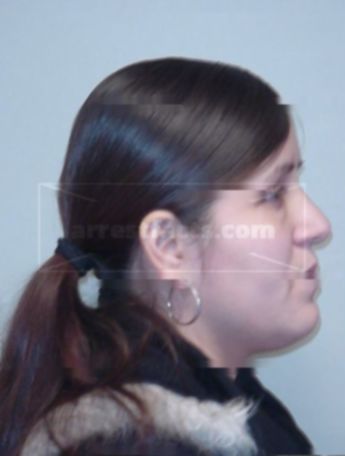 Vanessa M Blackdeer