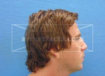 Zachary William Schultz