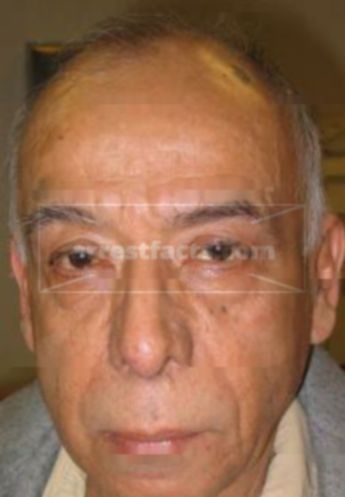 Moises Gomez