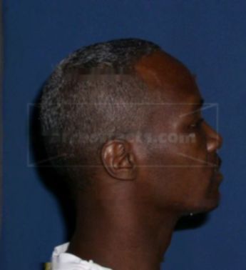 Tyrone Cross