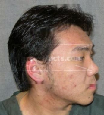 Pao Khang