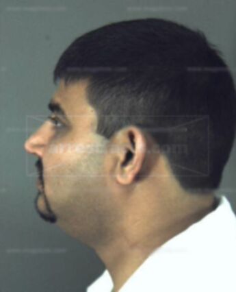 Chandrakant A Patel