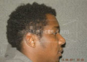 Leon A Mckinney