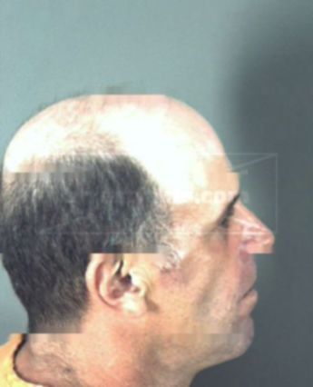 Dale Len Billings