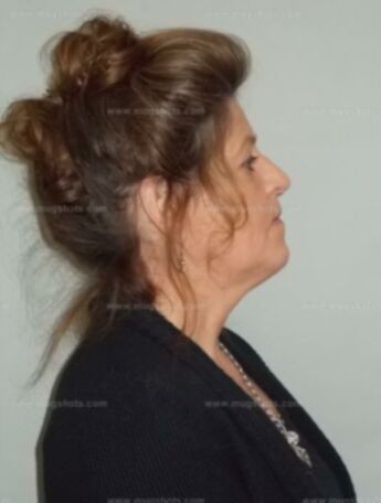 Teresa L Oliphant
