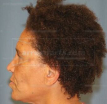 Brenda L Adams