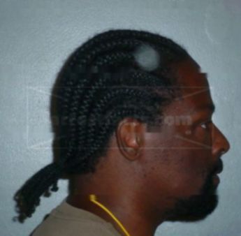 Timothy C Patterson