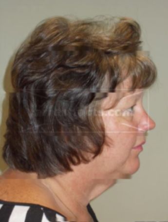 Debra A Checolinski
